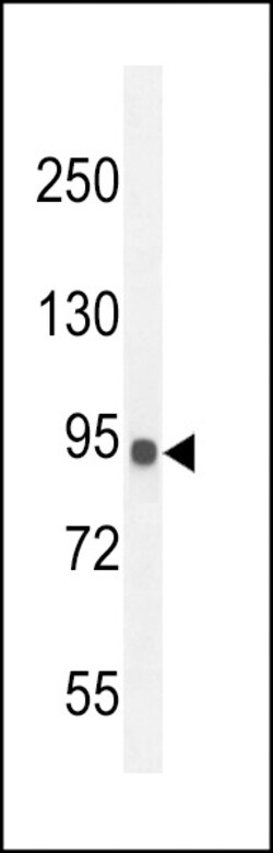 Invitrogen IL12RB2 Polyclonal Antibody 400 &mu;L; Unconjugated:Antibodies,