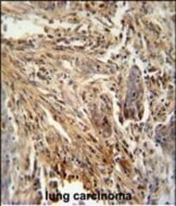 Invitrogen GM-CSF Polyclonal Antibody 400 &mu;L; Unconjugated:Anticuerpos