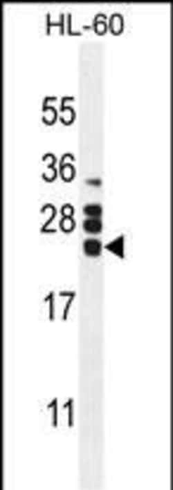 Invitrogen GM-CSF Polyclonal Antibody 400 &mu;L; Unconjugated:Anticuerpos