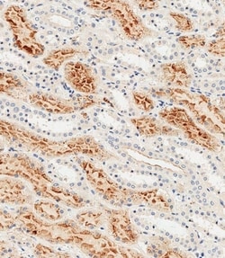 Invitrogen Folate Receptor alpha Polyclonal Antibody 400 &mu;L | Buy Online | Invitrogen&trade; | Fisher Scientific