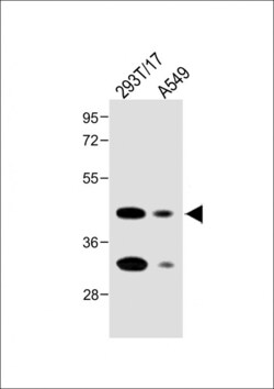 Invitrogen Folate Receptor alpha Polyclonal Antibody 400 &mu;L | Buy Online | Invitrogen&trade; | Fisher Scientific