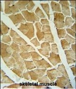 ARHGAP10 Polyclonal Antibody:Antibodies, Polyclonal