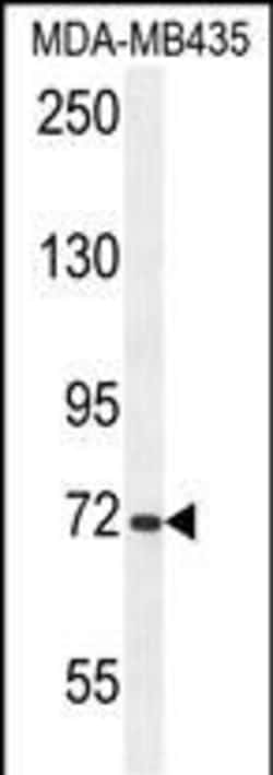 ARHGAP10 Polyclonal Antibody:Antibodies, Polyclonal