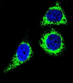 Bcl-10 Polyclonal Antibody:Antibodies, Polyclonal