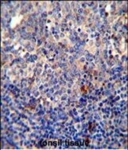 Bcl-10 Polyclonal Antibody:Antibodies, Polyclonal