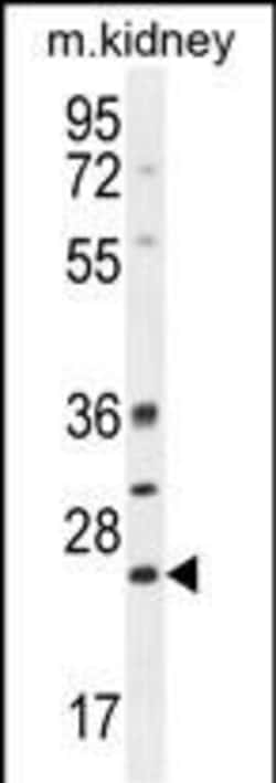 Bcl-10 Polyclonal Antibody:Antibodies, Polyclonal