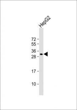 Invitrogen CES4 Polyclonal Antibody 400 &mu;L; Unconjugated:Antibodies,