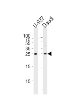 Invitrogen CD37 Polyclonal Antibody 400 &mu;L; Unconjugated:Antibodies,