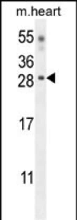 Invitrogen Claudin 6 Polyclonal Antibody 200 μL; Unconjugated:Antibodies,
