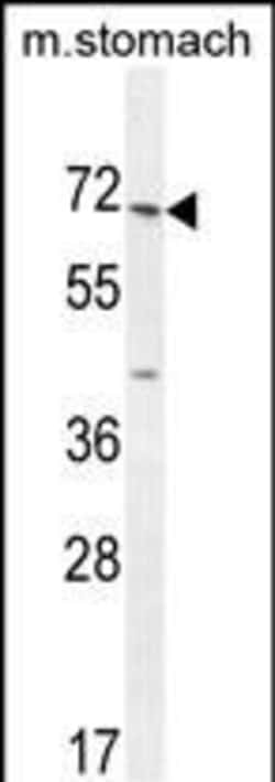 Invitrogen ESCO2 Polyclonal Antibody 400 &mu;L; Unconjugated:Antibodies,