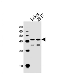 Invitrogen ETS1 Polyclonal Antibody 400 &mu;L; Unconjugated:Antibodies,