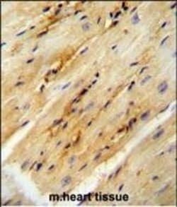 GPD1L Polyclonal Antibody:Antibodies, Polyclonal