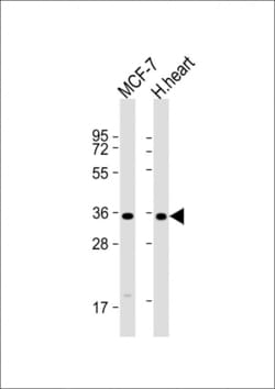 GPD1L Polyclonal Antibody:Antibodies, Polyclonal