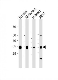 GPD1L Polyclonal Antibody:Antibodies, Polyclonal