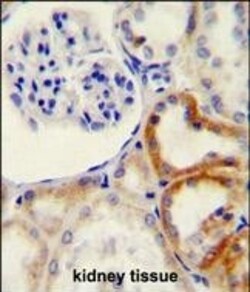 HYAL2 Polyclonal Antibody:Antibodies, Polyclonal