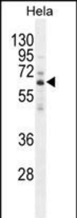 HYAL2 Polyclonal Antibody:Antibodies, Polyclonal