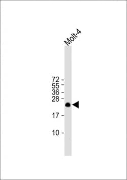 ORMDL3 Polyclonal Antibody:Antibodies, Polyclonal