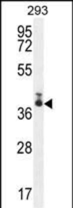 Invitrogen TMEM66 Polyclonal Antibody 400 &mu;L; Unconjugated:Antibodies,