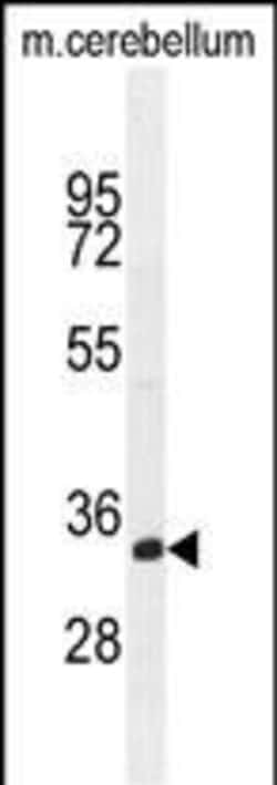 Invitrogen TMEM66 Polyclonal Antibody 400 &mu;L; Unconjugated:Antibodies,