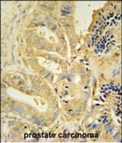 Invitrogen TLL1 Polyclonal Antibody 400 &mu;L | Buy Online | Invitrogen&trade; | Fisher Scientific
