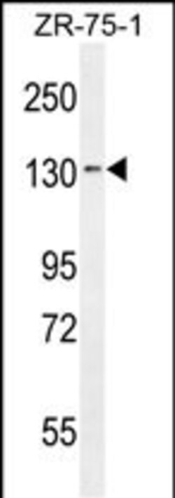 Invitrogen TLL1 Polyclonal Antibody 400 &mu;L | Buy Online | Invitrogen&trade; | Fisher Scientific