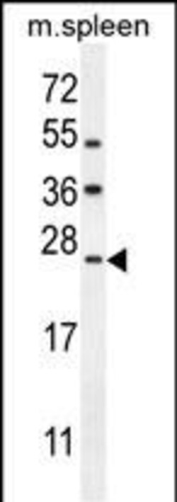 Invitrogen LMO4 Polyclonal Antibody 400 &mu;L | Buy Online | Invitrogen&trade; | Fisher Scientific