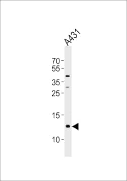 Invitrogen SPRR2A Polyclonal Antibody 400 &mu;L | Buy Online | Invitrogen&trade; | Fisher Scientific