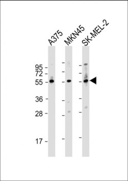 Invitrogen GSDMC Polyclonal Antibody 400 μL; Unconjugated:Antibodies,
