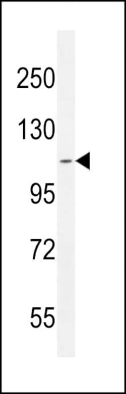 Invitrogen ATP8B2 Polyclonal Antibody 400 &mu;L; Unconjugated:Antibodies,
