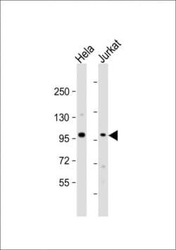 Invitrogen NSUN2 Polyclonal Antibody 400 &mu;L; Unconjugated:Antibodies,