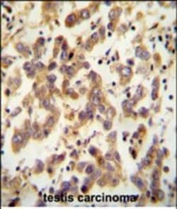 CT173 Polyclonal Antibody:Antibodies, Polyclonal