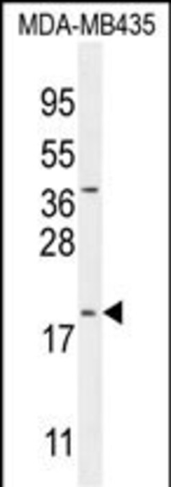 CT173 Polyclonal Antibody:Antibodies, Polyclonal