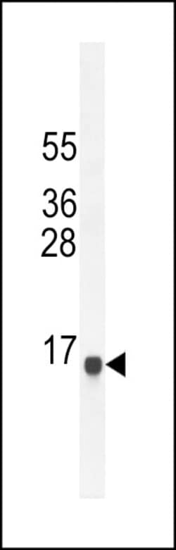 Invitrogen SPAG11A Polyclonal Antibody 400 &mu;L; Unconjugated:Antibodies,