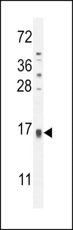 Invitrogen TCL6 Polyclonal Antibody 400 &mu;L; Unconjugated:Antibodies,