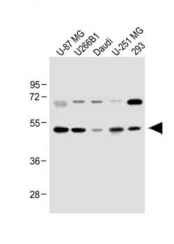 Invitrogen WDR41 Polyclonal Antibody 400 &mu;L; Unconjugated:Anticorps,