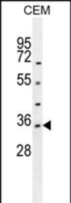 Invitrogen LDHAL6A Polyclonal Antibody 400 &mu;L; Unconjugated:Antibodies,