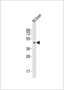 Invitrogen SLC16A11 Polyclonal Antibody 400 &mu;L; Unconjugated:Antibodies,