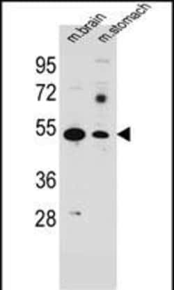 Invitrogen SLC16A11 Polyclonal Antibody 400 &mu;L; Unconjugated:Antibodies,