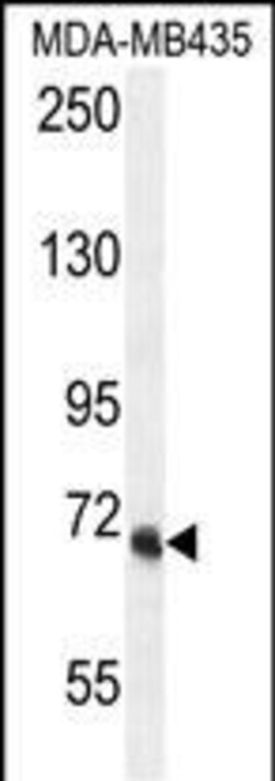 Invitrogen VPS52 Polyclonal Antibody 400 &mu;L | Buy Online | Invitrogen&trade; | Fisher Scientific