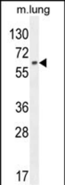 Invitrogen NFE2L1 Polyclonal Antibody 400 &mu;L; Unconjugated:Anticuerpos