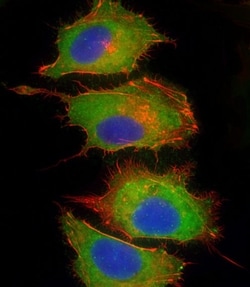 Invitrogen Complement Factor H Polyclonal Antibody 400 &mu;L; Unconjugated:Antibodies,