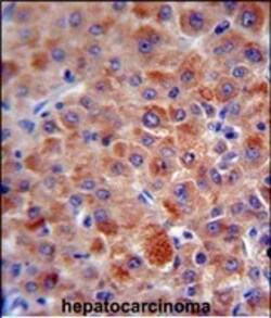 Invitrogen Complement Factor H Polyclonal Antibody 400 &mu;L; Unconjugated:Antibodies,