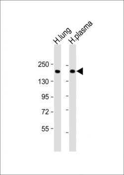 Invitrogen Complement Factor H Polyclonal Antibody 400 &mu;L; Unconjugated:Antibodies,