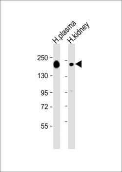 Invitrogen Complement Factor H Polyclonal Antibody 400 &mu;L; Unconjugated:Antibodies,