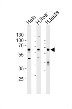 Invitrogen Apolipoprotein J Polyclonal Antibody 400 &mu;L | Buy Online | Invitrogen&trade; | Fisher Scientific