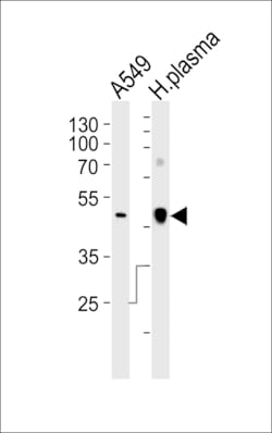 Invitrogen Apolipoprotein J Polyclonal Antibody 400 &mu;L | Buy Online | Invitrogen&trade; | Fisher Scientific
