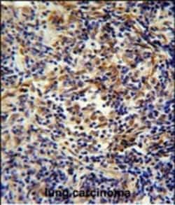 Invitrogen CASKIN2 Polyclonal Antibody 400 &mu;L; Unconjugated:Antibodies,