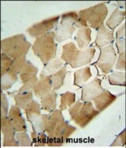 Invitrogen CDKN2C Polyclonal Antibody 400 &mu;L; Unconjugated:Antibodies,