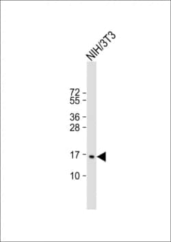 Invitrogen CDKN2C Polyclonal Antibody 400 &mu;L; Unconjugated:Antibodies,