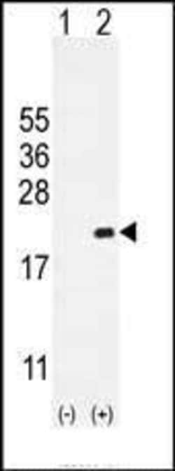 Invitrogen CDKN2C Polyclonal Antibody 400 &mu;L; Unconjugated:Antibodies,